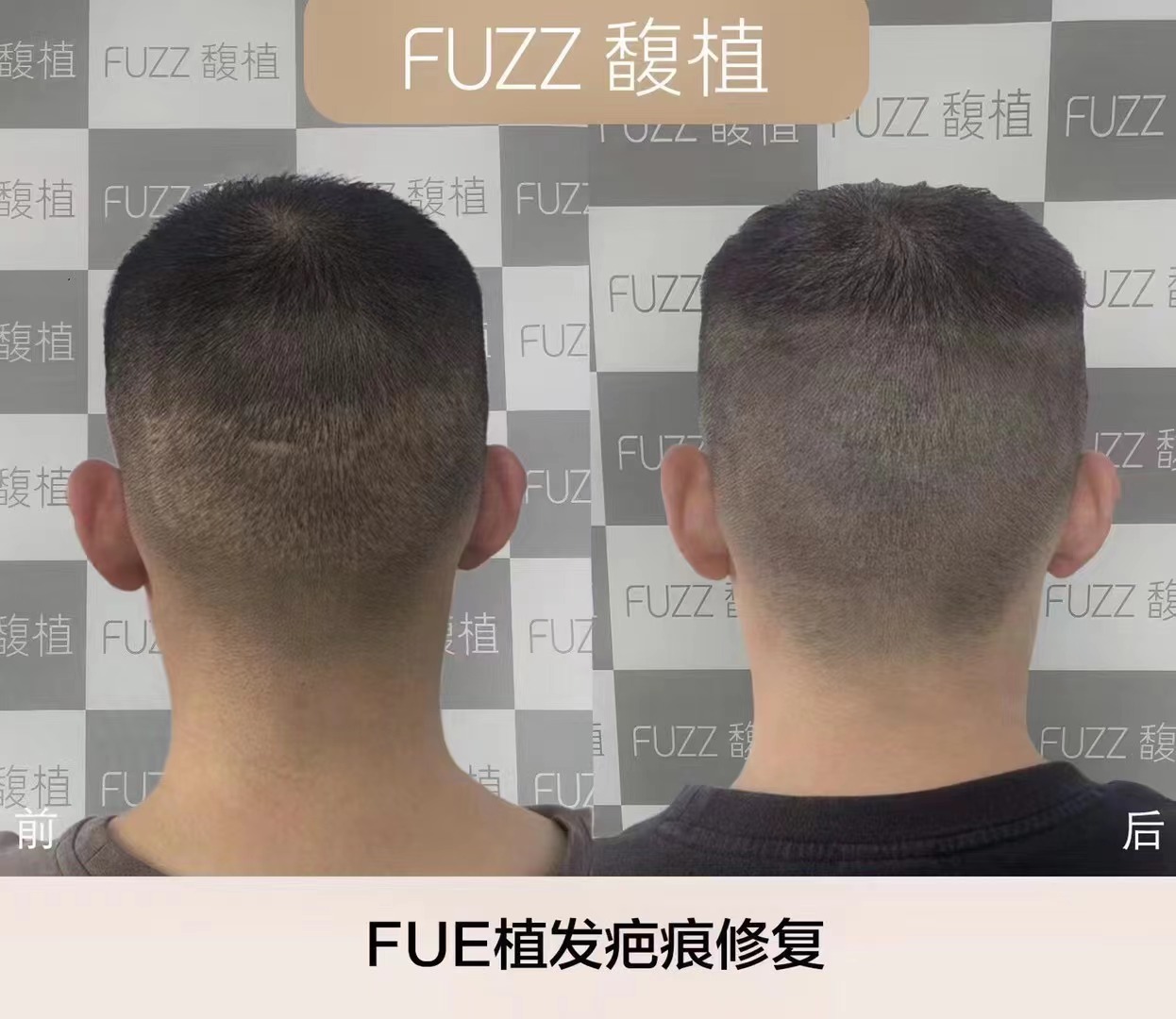 纹发效果
