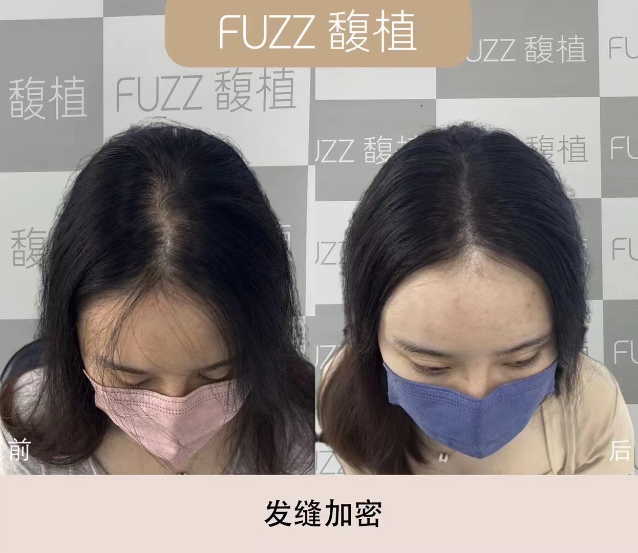 纹发效果