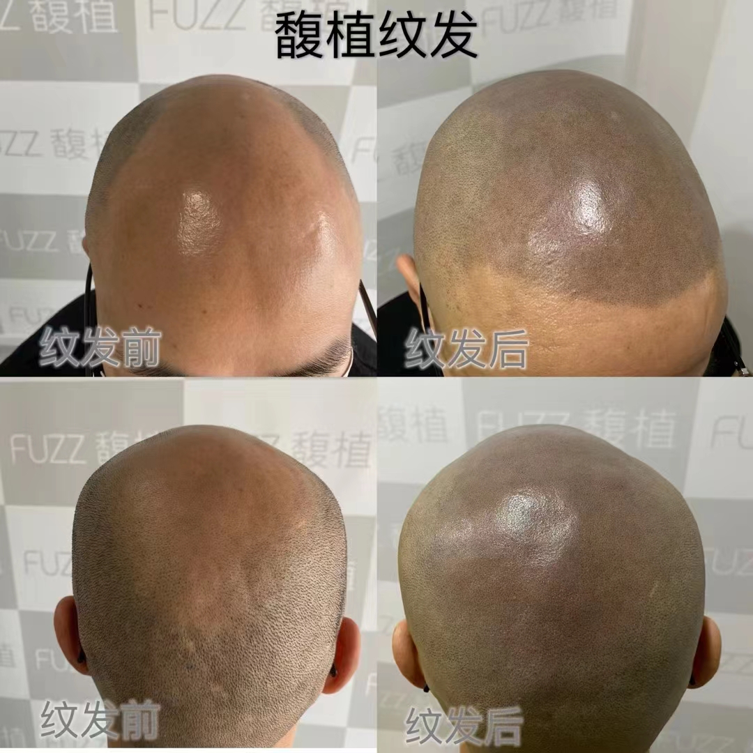 纹发