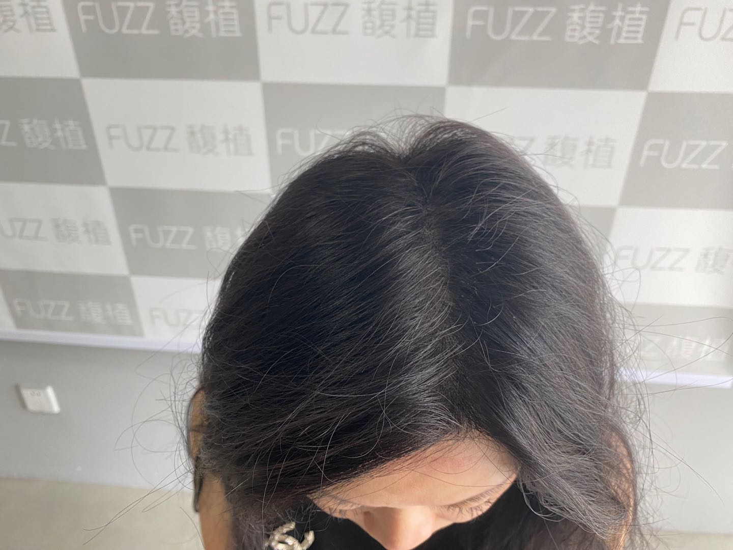 纹发
